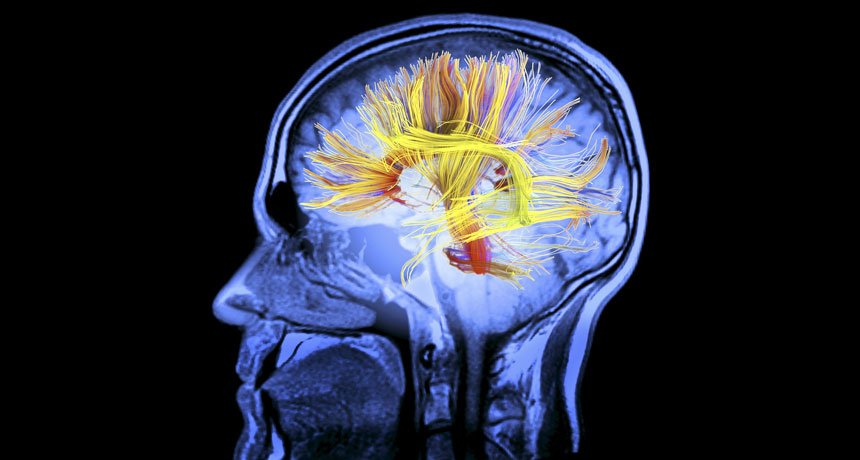 Araştırmacılar beynin ruh halini değiştiren kısmını sıfırlıyor