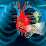 Yeni İmplant, Kalp Atışınızı Kullanarak Cyborg Cihazlarını Güçlendiriyor
