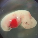 İnsan Gelişiminde Büyük Adım, Laboratuar Ortamında Yapılan İnsan “Embriyo”