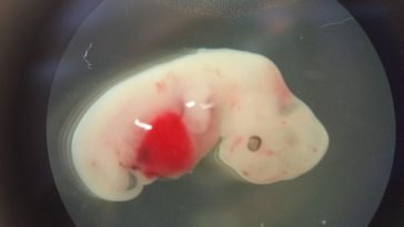 İnsan Gelişiminde Büyük Adım, Laboratuar Ortamında Yapılan İnsan “Embriyo”