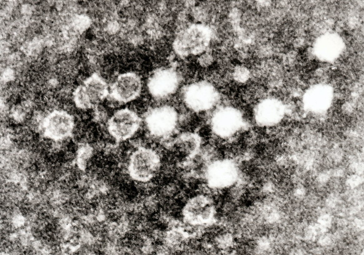 Parvovirüs Görüntüsü