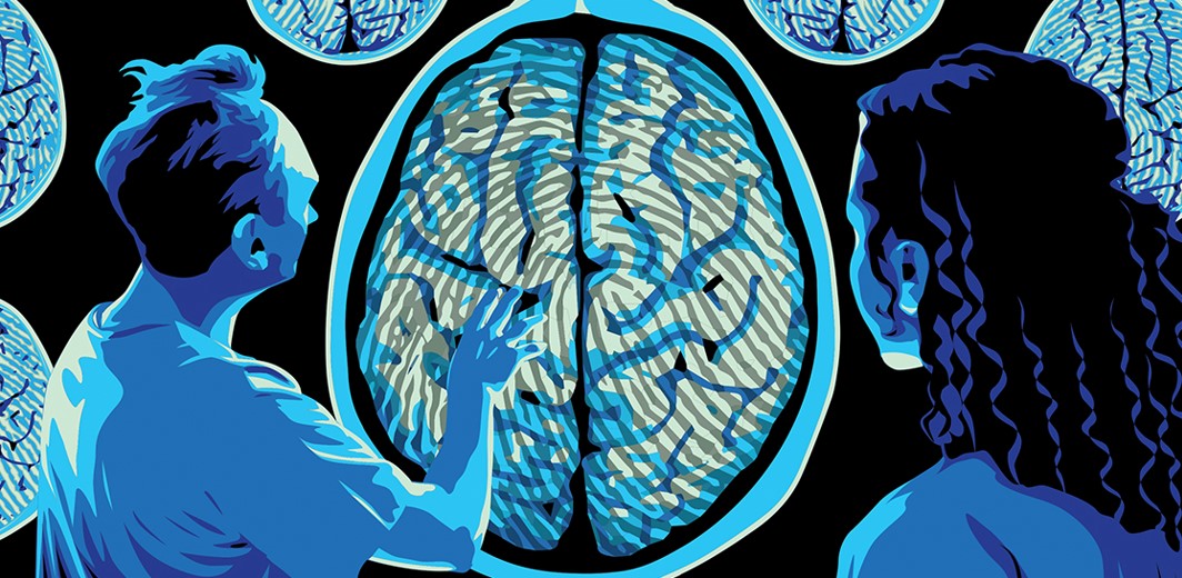 Her İnsanın Benzersiz Bir Beyin Anatomisine Sahip