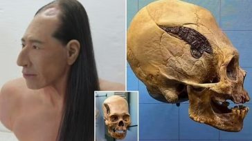 2000 yıl önce Perulu savaşçının kafasına yerleştirilen metal plaka dünyanın ilk kafatası ameliyatı olduğu düşünülüyor.
