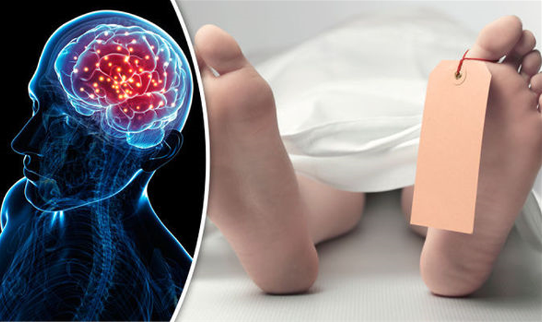 Ölen Bir İnsanın Beyin Dalgaları İlk Kez Detaylı Olarak Kaydedildi