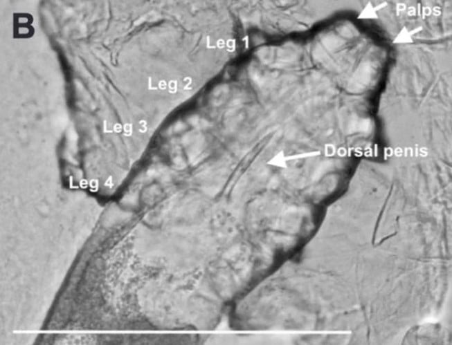 Demodex folliculorum mikroskobik görüntüsü