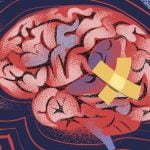 Beyin Kendini İyileştirebilir Mi?