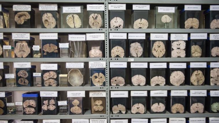 insan beyin koleksiyonu