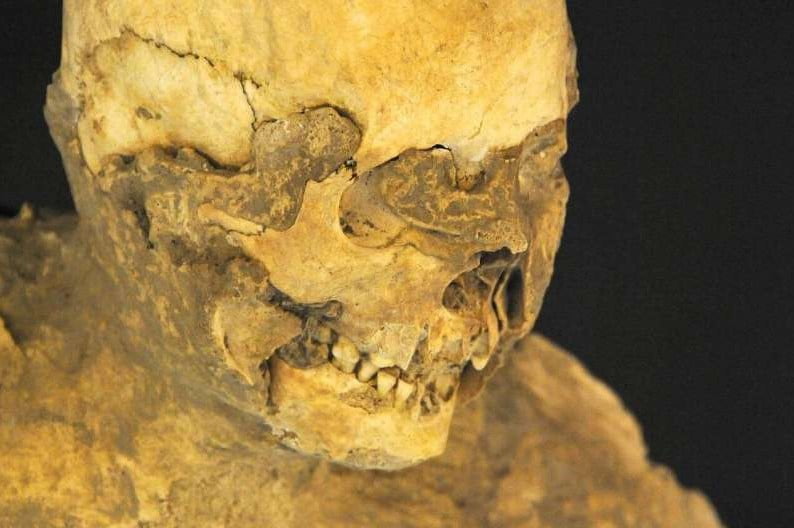 Pompei civarındaki insan bedenleri neden patlamaya dayanamadı?