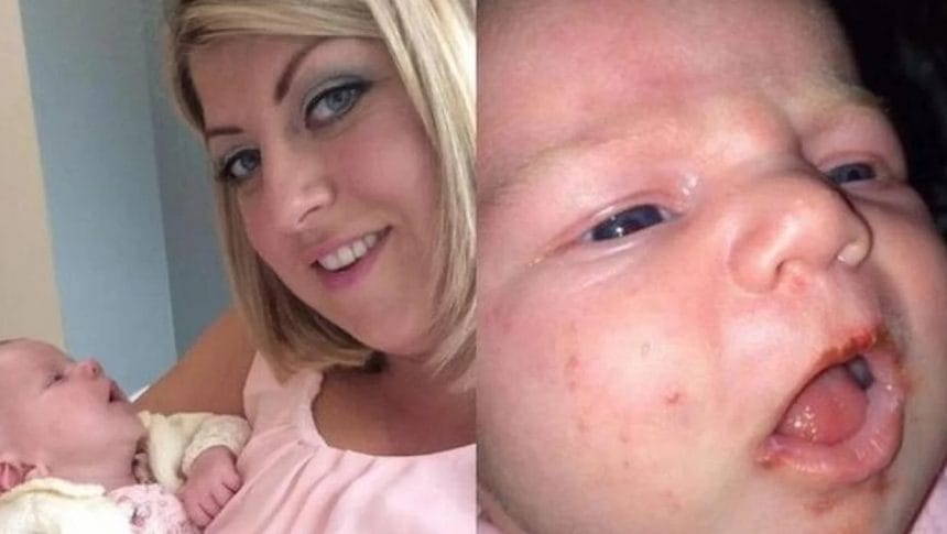 Doktorlar Uyardı: Bebekleri Öpmek Ölümcül ve Tehlikeli Olabilir, İşte Nedeni