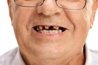Japonlar Dişleri Yeniden Çıkaracak Yeni İlacın İnsan Denemelerine Başladı