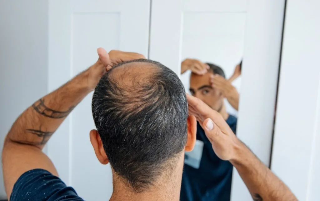 Saç Dökülmesine Karşı Yeni Umut: Saç Köklerini Koruyan Protein Bulundu!