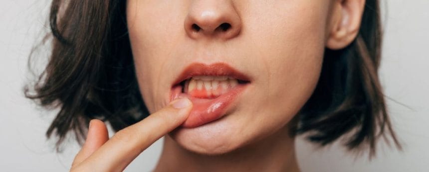 Ağız Sağlığınız Kalbinizi Tehdit Ediyor Olabilir: Uzmanlar Uyarıyor