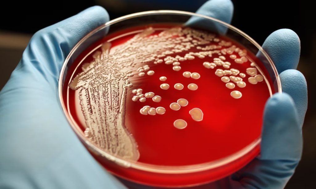 İnsan Derisinde Yaşayan Mantarlar Yeni Antibiyotiklerin Kaynağı Olabilir