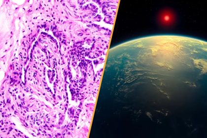 Uzak Bir Gezegenin Atmosferinde Yaşam İzleri mi Bulundu? Bilim Dünyası Heyecanlı