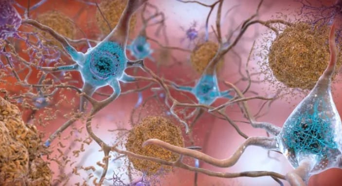 Fareler Üzerinde Yapılan Çalışma: Burun Karıştırmak Alzheimer ile Bağlantılı Olabilir