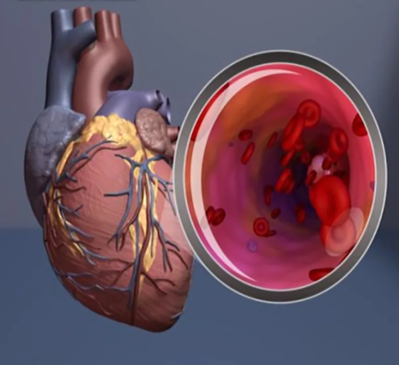 Ağız Sağlığı Kalp Sağlığının Anahtarı Olabilir: Diş Eti Hastalıkları ile Kalp-Damar Riski Arasındaki Bağ Güçleniyor