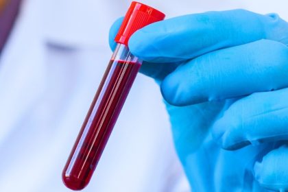 Basit Bir Kan Testi, Önümüzdeki 5–10 Yıl İçinde Ölüm Riskinizi Ortaya Koyabilir mi?