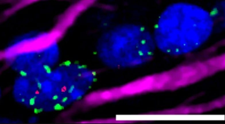 Kalorileri Yüzde 30 Azaltmak, Beyni Yaşlanmaya Karşı Koruyabilir
