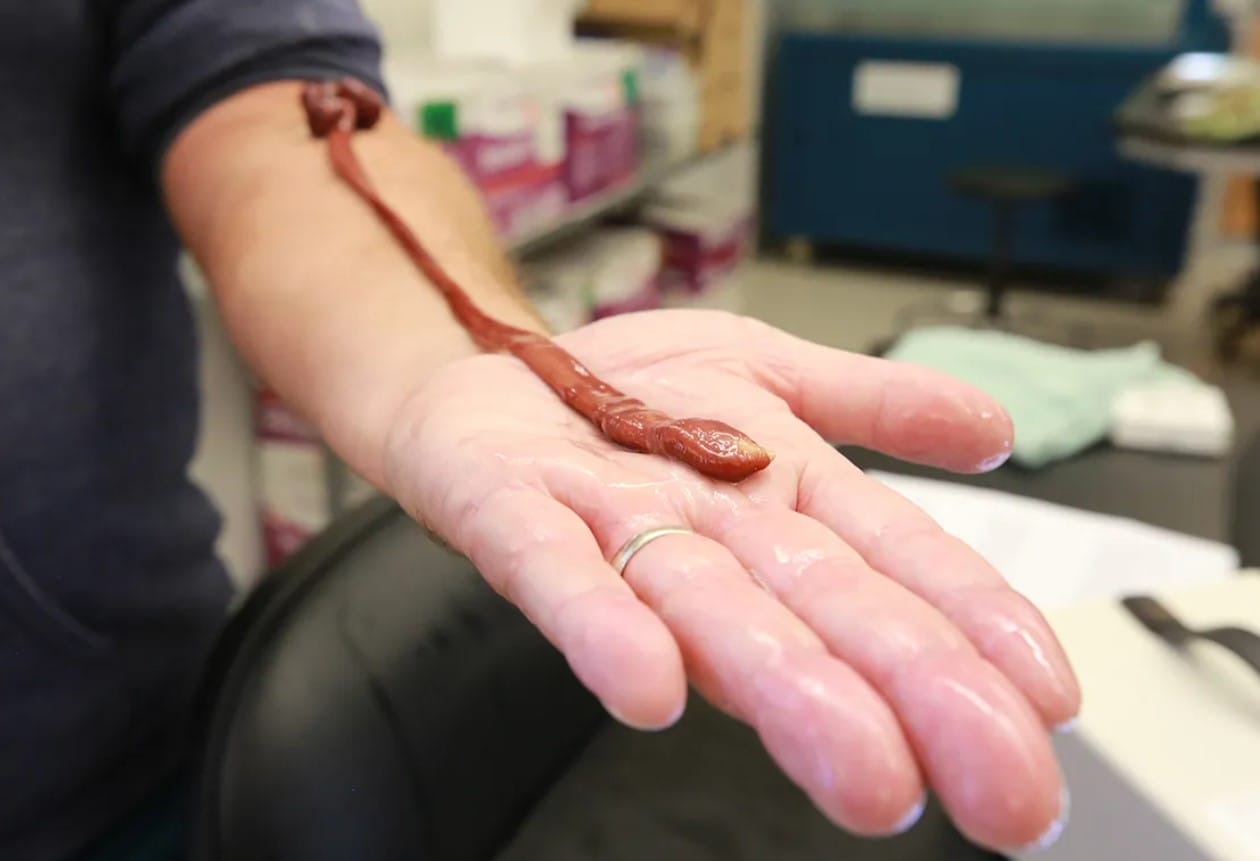 Onlarca Yıl Bir Laboratuvarda Sessizce Yaşadı: Bu Solucanın Gerçek Yaşı Bilimi Şaşırttı